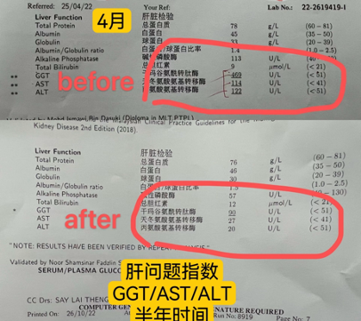 liver function test 6mths