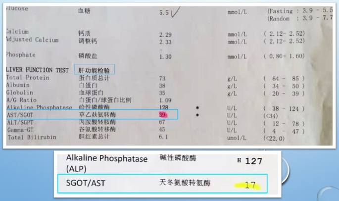 liver function test