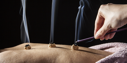 moxibustion